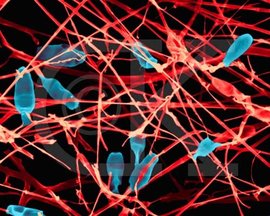 反硝化细菌_360百科