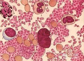 抗碱血红蛋白试验