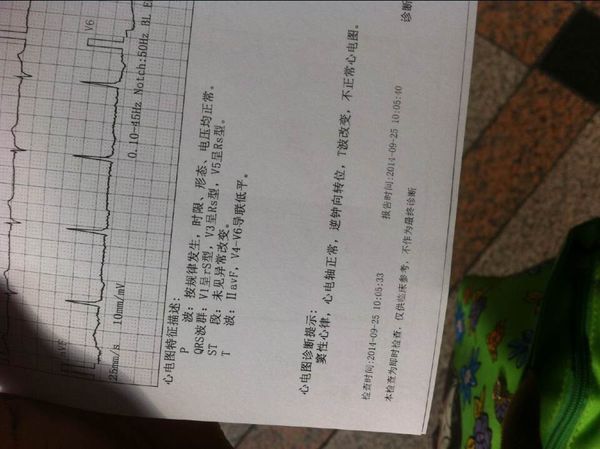 体检显示:不正常心电图,请问严重么_360问答