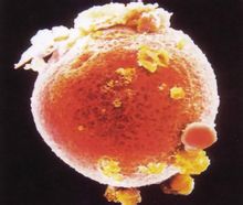 卵子如何从卵巢中获取：剖析卵子提取技术 (卵是怎么取出来的)